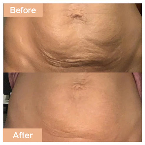Age-Defying Revival Collagen Body Oil