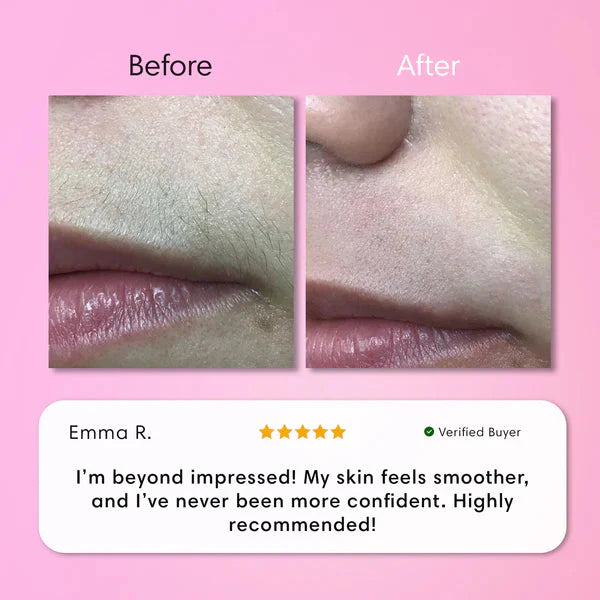 Facial Hair Removal Cream for Women | Upper Lip Chin & Peach Fuzz Remover