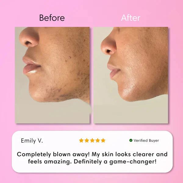 Facial Depilatory Cream for Women | Gentle Cream Hair Remover for Face