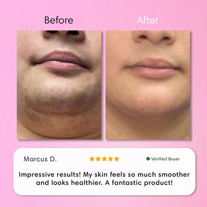 Facial Hair Removal Cream for Women | Upper Lip Chin & Peach Fuzz Remover