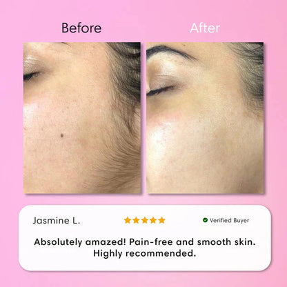 Facial Depilatory Cream for Women | Gentle Cream Hair Remover for Face