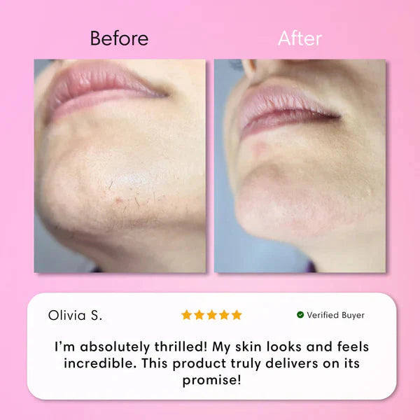 Facial Hair Removal Cream for Women | Upper Lip Chin & Peach Fuzz Remover