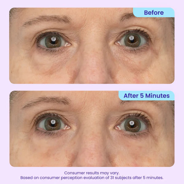 Eye Cream for Wrinkles | Collagen Under Eye Gel Stick for Fine Lines