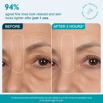 Forehead Wrinkle Patches | Face Tape for 11 Lines and Frown Lines