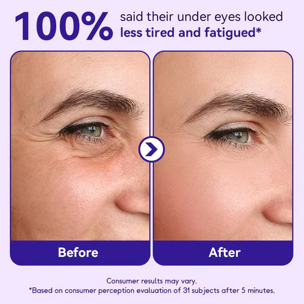 Eye Bag Cream for Puffy Eyes | Depuffing Under Eye Treatment Stick