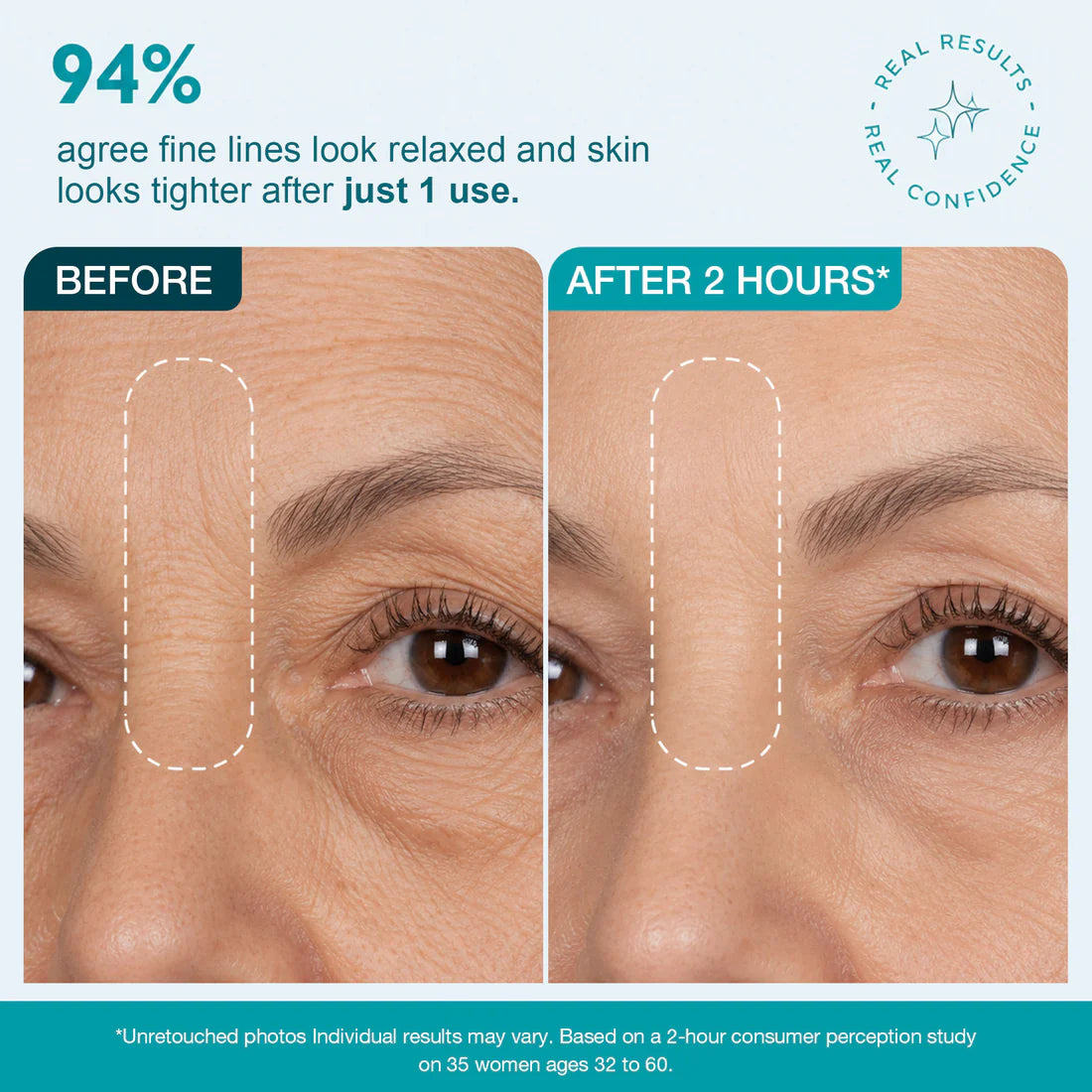 Face Tape for Wrinkles | Peptide Infused Face & Eye Tape