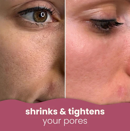 Brightening turmeric & kojic acid pads