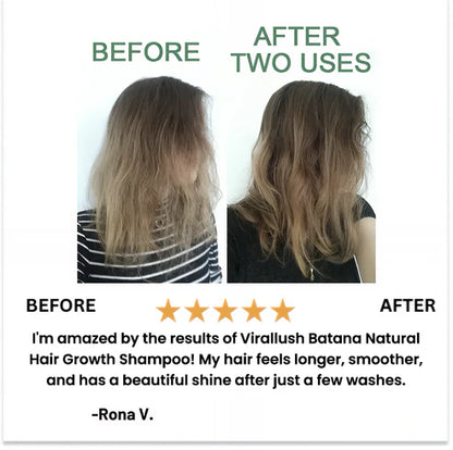 Batana Natural Hair Growth Shampoo
