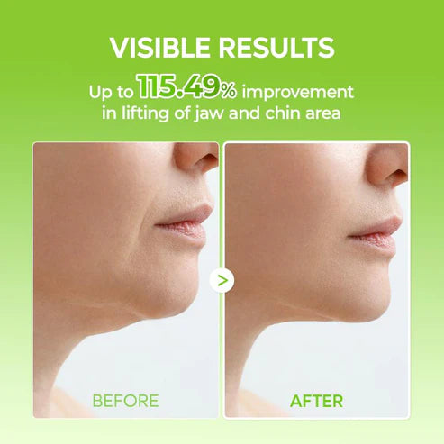 Cactox V-Lifting Mewing Band (4x Masks Per Pack)