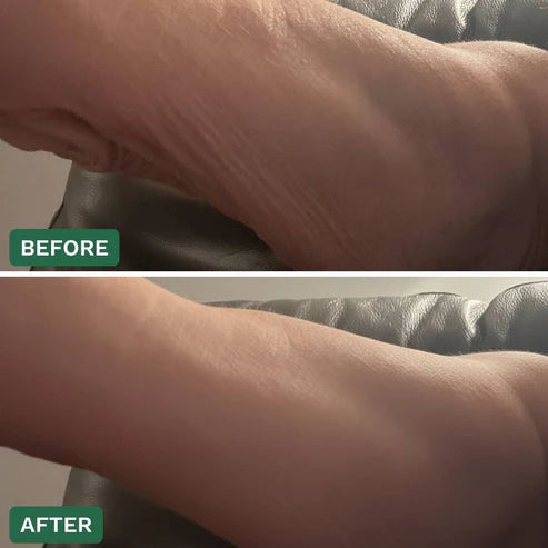 Crepey Skin Repair Cream