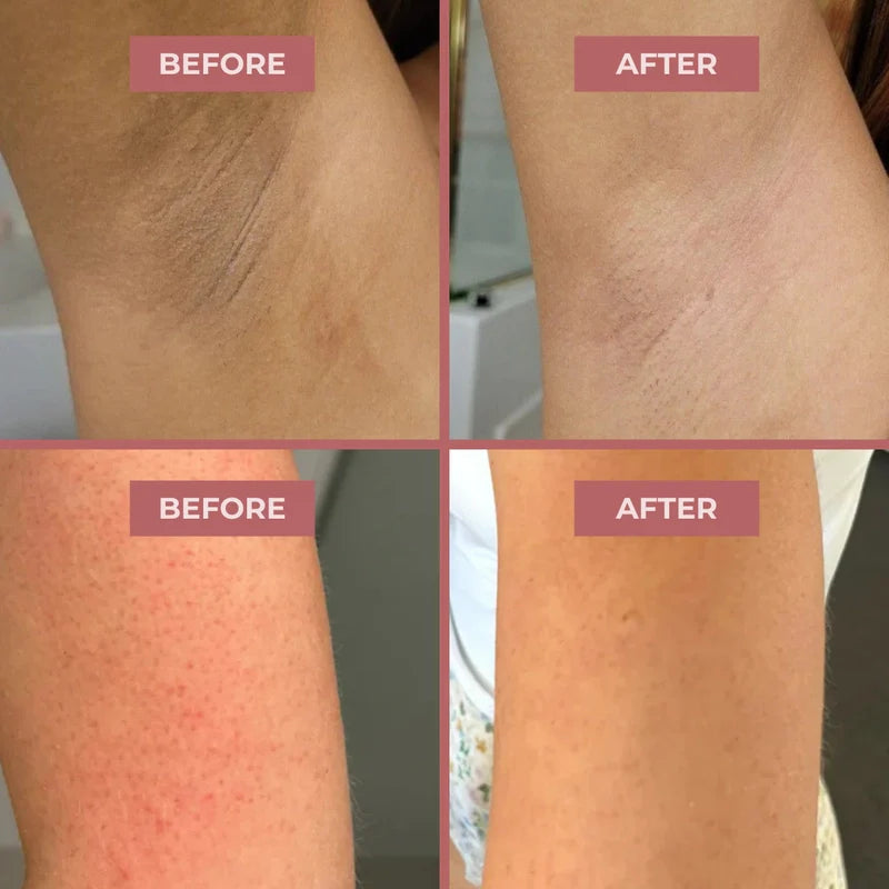 Body brightening results