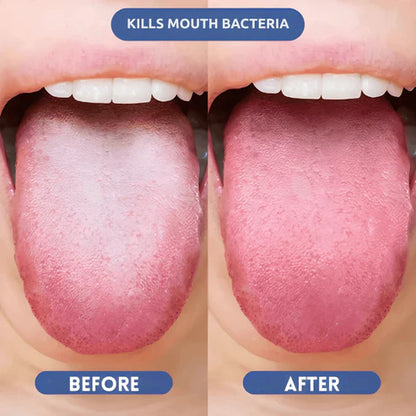 Probiotic Fresh Breath Spray