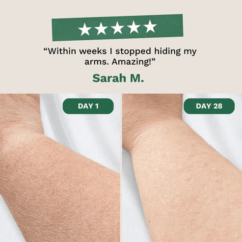 Crepey Skin Repair Cream