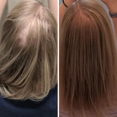 Hair result before and after