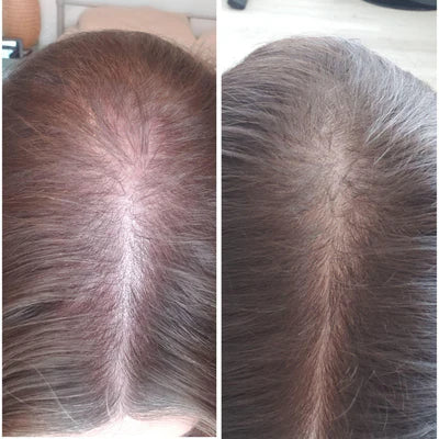 Hair result before and after