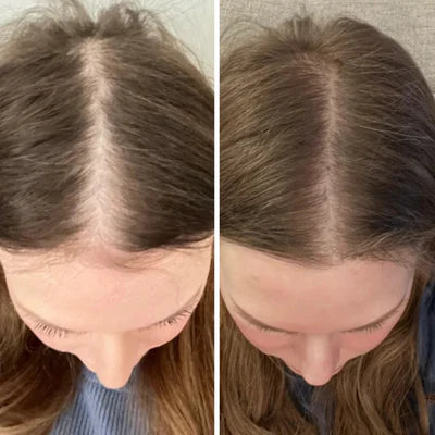 Hair result before and after
