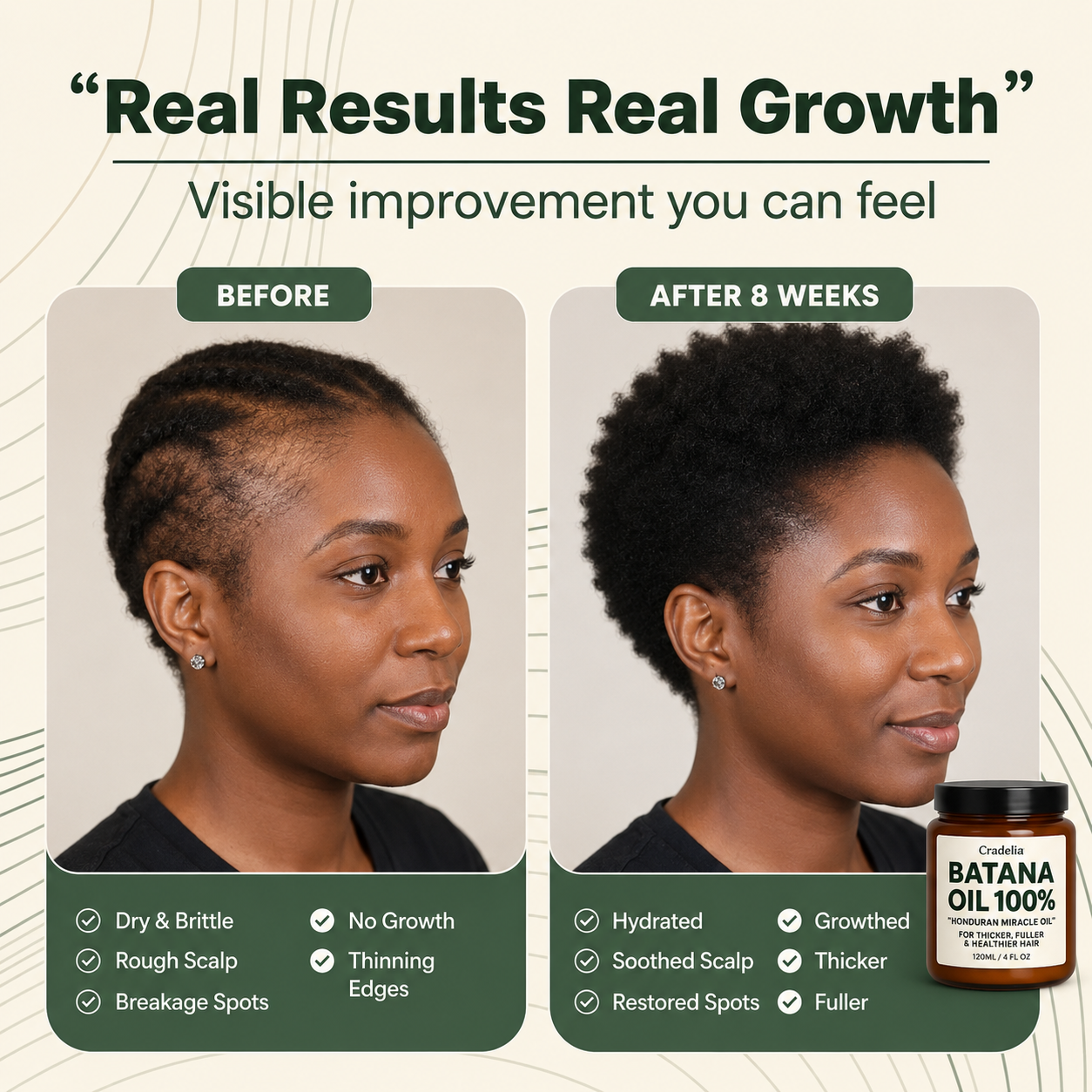 Batana Oil for Hair Growth | 100% Pure Honduran Hair Growth Oil for Thinning Hair & Fuller Hair