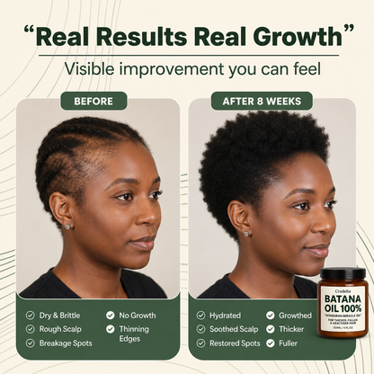 Batana Oil for Hair Growth | 100% Pure Honduran Hair Growth Oil for Thinning Hair & Fuller Hair