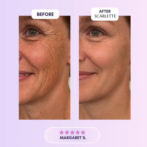 Silicone Collagen Sheets for Scars & Wrinkles