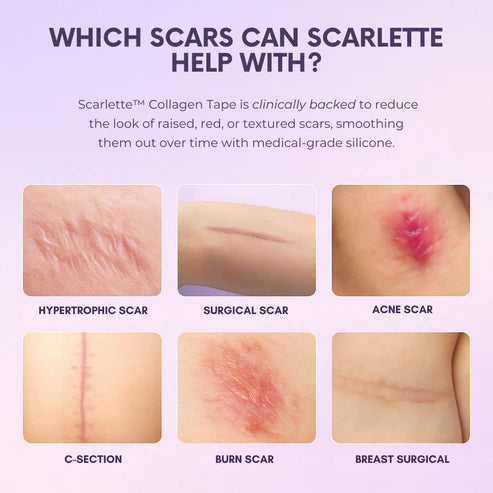 Silicone Collagen Sheets for Scars & Wrinkles