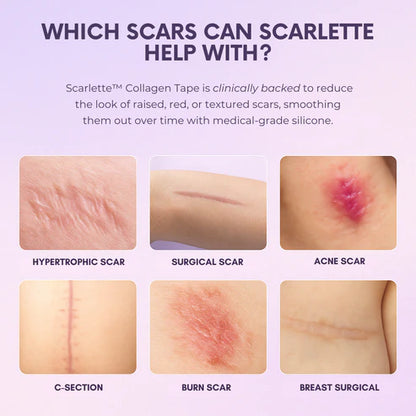 Silicone Collagen Sheets for Scars & Wrinkles