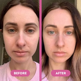Customer under-eye result