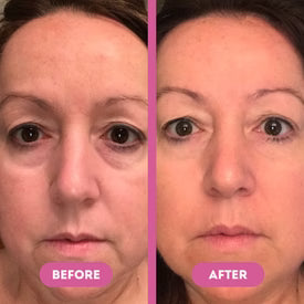 Customer under-eye result