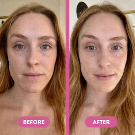 Customer under-eye result
