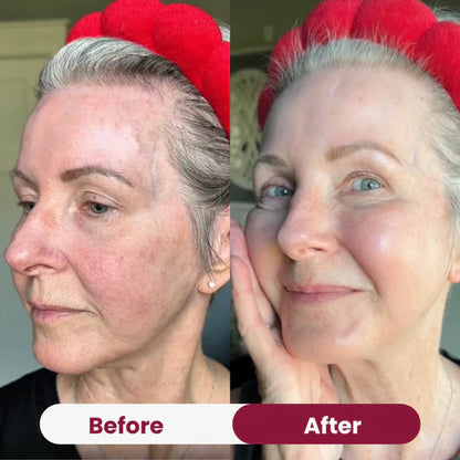 Bio-Collagen Mask 2.0