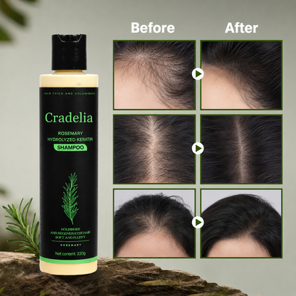 Rosemary Oil Shampoo with Hydrolyzed Keratin & Biotin – Scalp Care Shampoo for Thinning Hair, Weak Strands & Fuller-Looking Hair