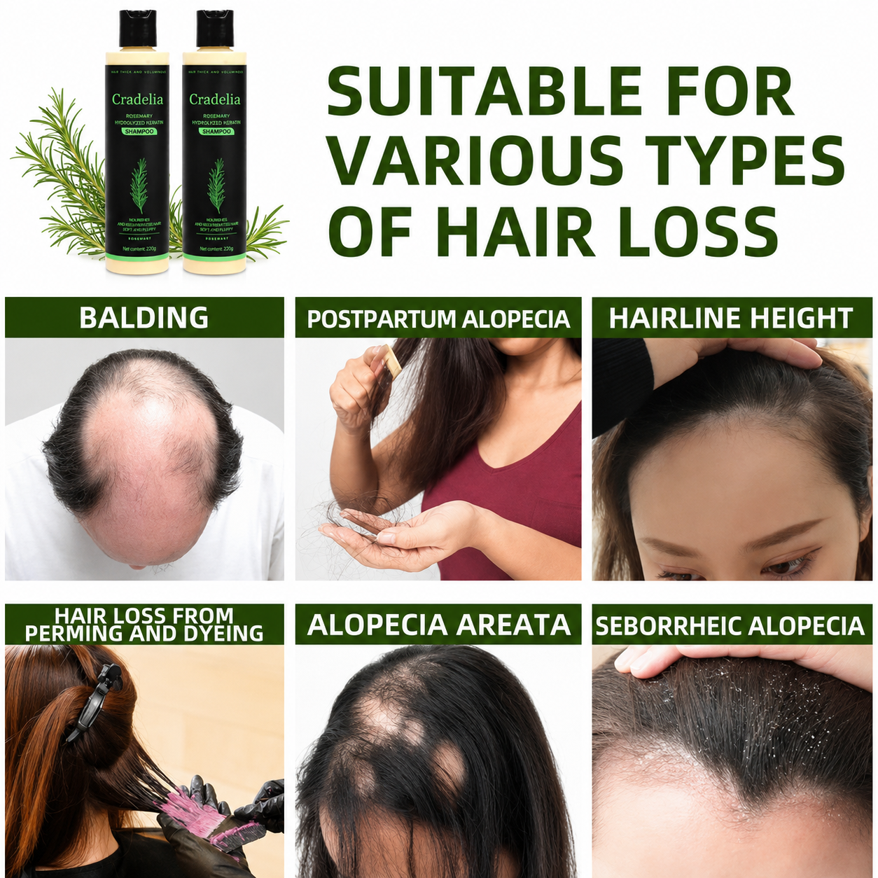 Rosemary Shampoo for Hair Growth – Rosemary Oil Thickening Shampoo for Thinning Hair, Hair Loss, Shedding & Stronger Fuller Hair