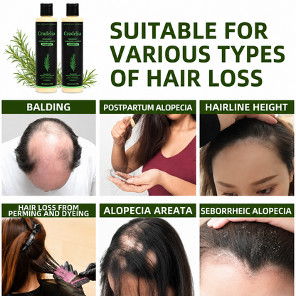 Rosemary Shampoo for Hair Growth – Rosemary Oil Thickening Shampoo for Thinning Hair, Hair Loss, Shedding & Stronger Fuller Hair