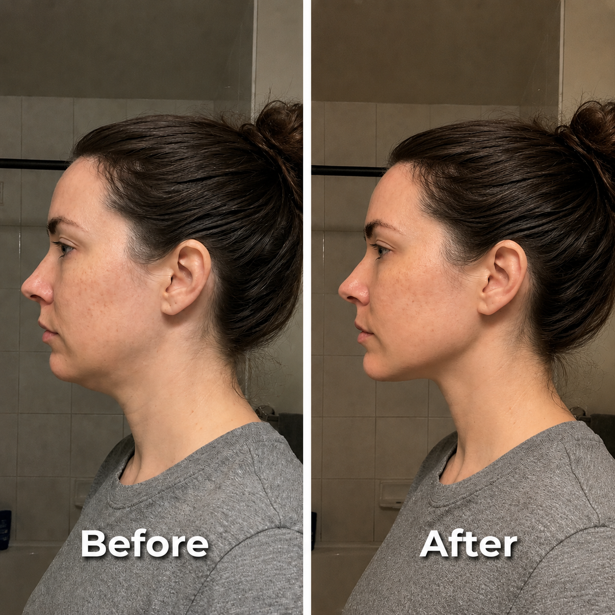 Lymphatic Face Brush
