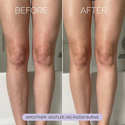 Hair Removal Cream for Women & Men | Painless Hair Removal Mousse for Sensitive Skin