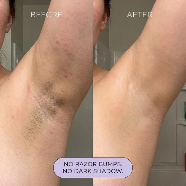 Hair Removal Cream for Women & Men | Painless Hair Removal Mousse for Sensitive Skin