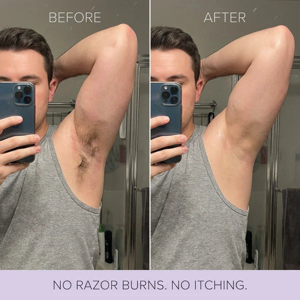Hair Removal Cream for Women & Men | Painless Hair Removal Mousse for Sensitive Skin