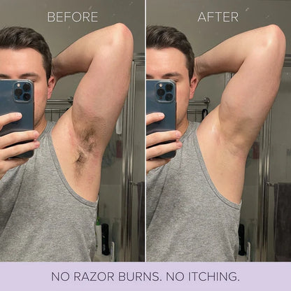 Hair Removal Cream for Women & Men | Painless Hair Removal Mousse for Sensitive Skin