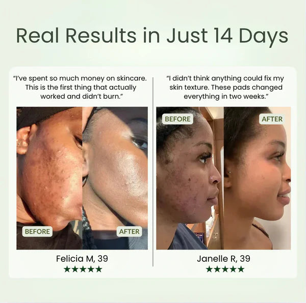 Korean Toner Pads for Glass Skin & Hydration | Exfoliating Face Pads