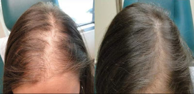 Hair result before and after