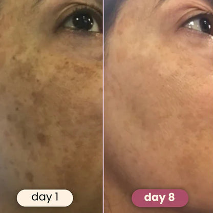 Brightening turmeric & kojic acid pads