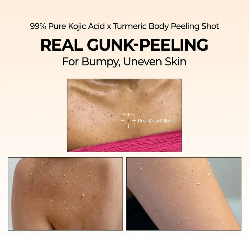 Real gunk peeling for bumpy uneven skin