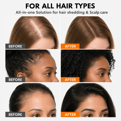 Hair Growth Serum for Thinning Hair & Hair Loss | Korean Scalp Treatment with Built-In Brush