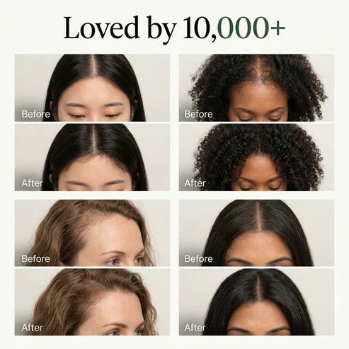 Korean Scalp Revival Bar